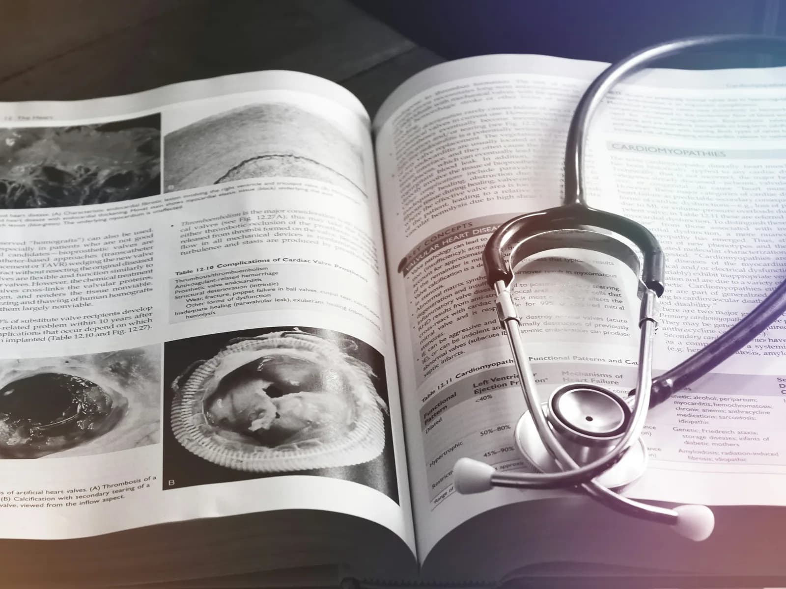 A stethoscope lying across an open medical textbook
